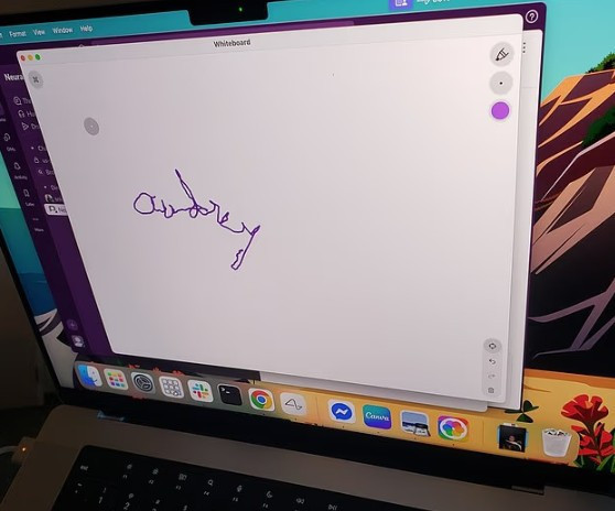 20 yıldır felçli kadın, beyin çipinin şoke edici etkisini gösterdi - Resim : 2