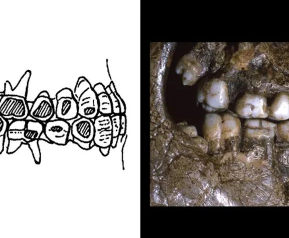 29 bin yıllık diş kanıtı: Buz Devri insanları yanak piercingi kullanıyormuş