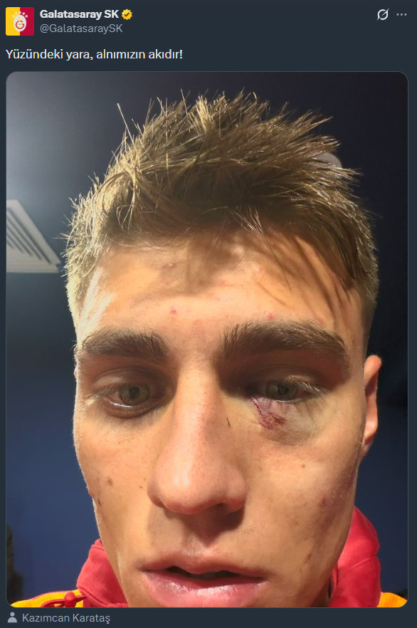 Kazımcan Karataş'ı yaralayan taraftar yakalandı - Resim : 1