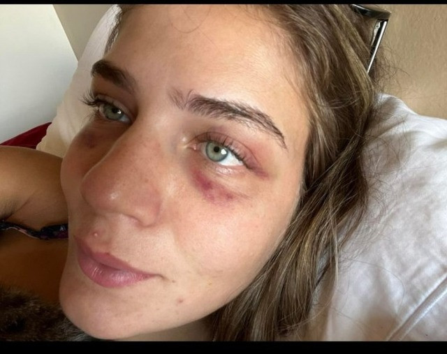 Ünlü futbolcudan model sevgilisine cinsel ve psikolojik şiddet! - Resim : 5