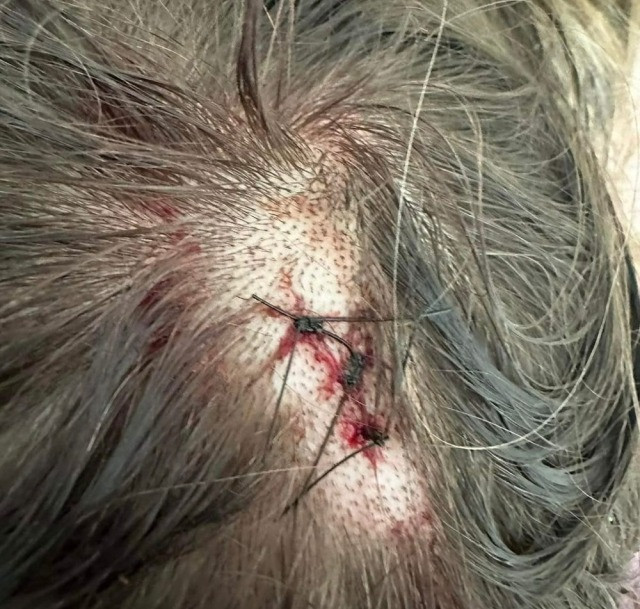 Ünlü futbolcudan model sevgilisine cinsel ve psikolojik şiddet! - Resim : 2