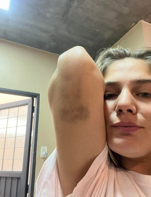 Ünlü futbolcudan model sevgilisine cinsel ve psikolojik şiddet! - Resim : 3