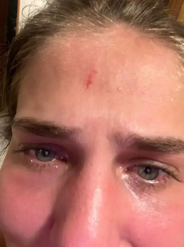 Ünlü futbolcudan model sevgilisine cinsel ve psikolojik şiddet! - Resim : 4