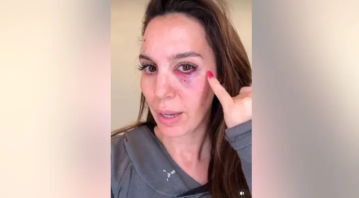Ünlü oyuncu atıcılık yaparken ölümden döndü - Resim : 2