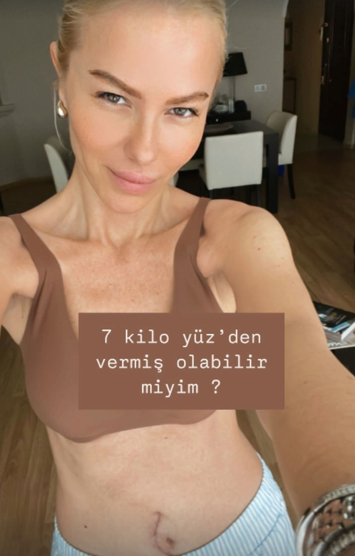 Seçil Gür zor günleri anlattı: “Yumurtalığım alındı, 1 ayda 9 kilo verdim" - Resim : 1