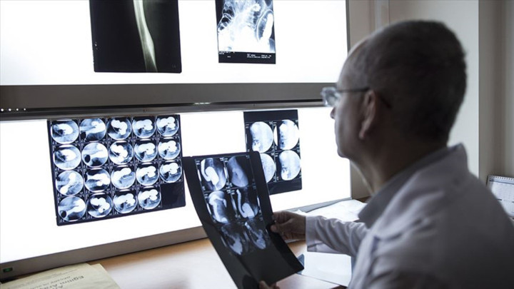 Küresel kanser araştırmasında korkutan rakamlar