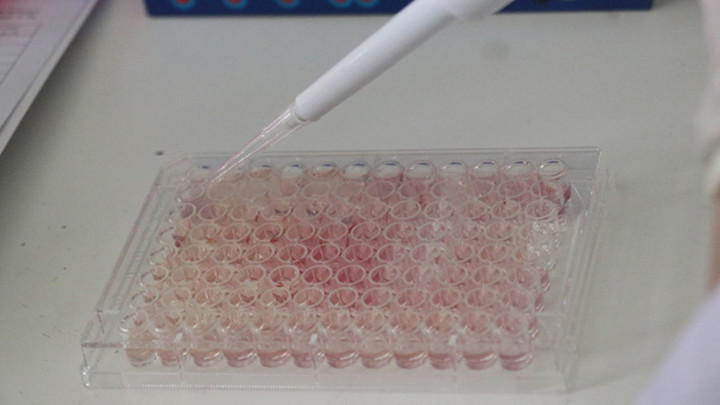 Mutluluk hormonunun kanserle sürpriz ilişkisi keşfedildi