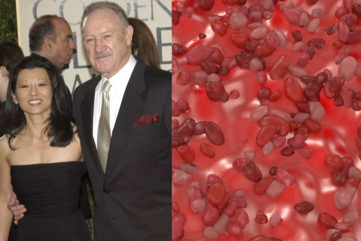 Usta oyuncunun eşini öldüren virüs paniğe neden oldu