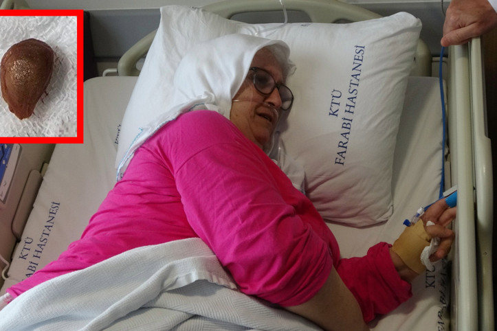 Yuttuğu karayemiş çekirdeği akciğerini çürüttü