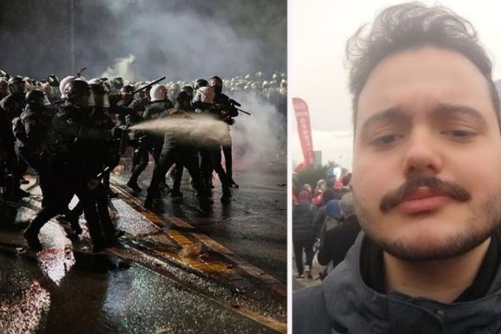 Üniversiteli gençten suç duyurusu: 'Polis saatlerce dövdü, avukat 'dozu azaltın' dedi'