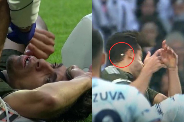 Beşiktaşlı yıldızın dişi kırıldı, Solskjaer'in tepkisi güldürdü