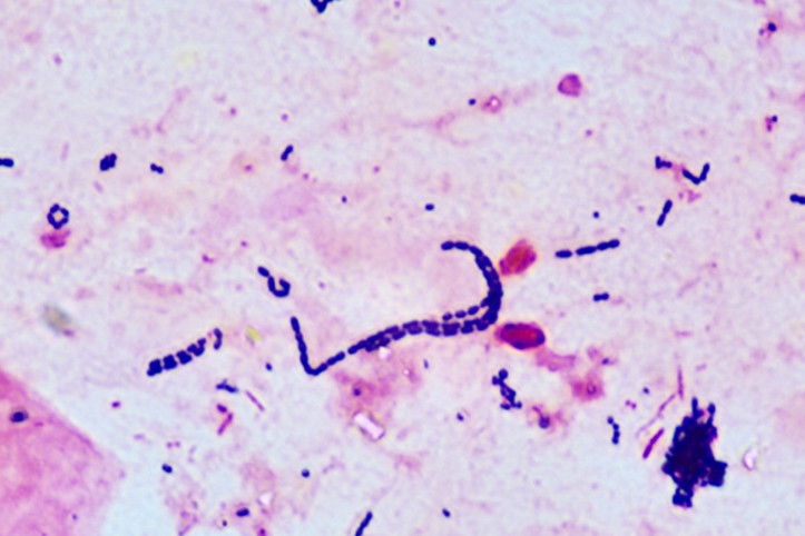 Komşuda bakteri paniği: Eğitime ara verildi