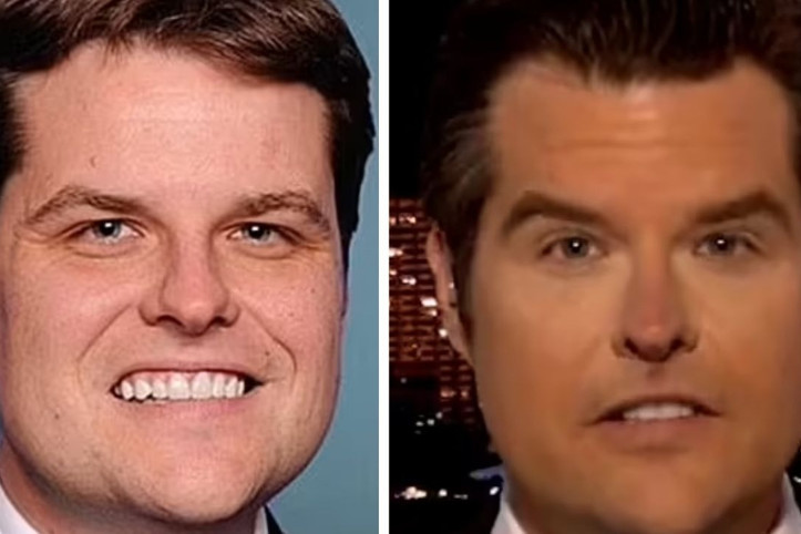 Washington'da yeni moda: Erkek siyasetçiler estetiğe dadandı