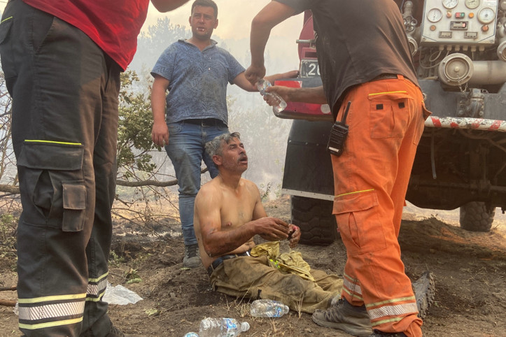 Rüzgar yön değiştirince alevlerin arasında kaldı: Orman işçisi yoğun bakımda