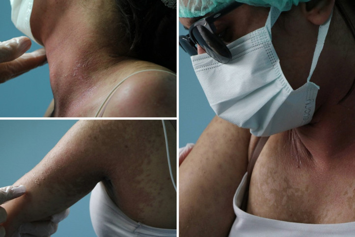 İnternetten aldığı krem yüzünden hastanelik oldu: İçeriği şok etti