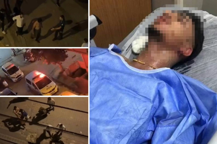 Sultangazi’de olaylı gece: Sokak ortasında bıçaklı ve sopalı dehşet!
