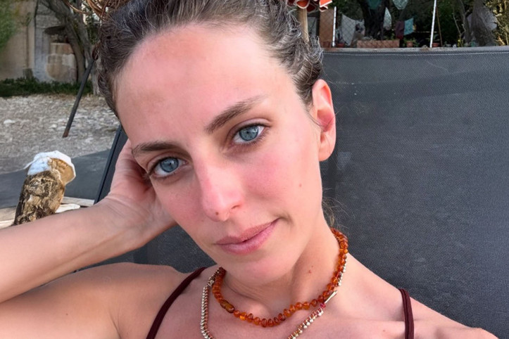 Bige Önal akrep sokması nedeniyle hastaneye kaldırıldı