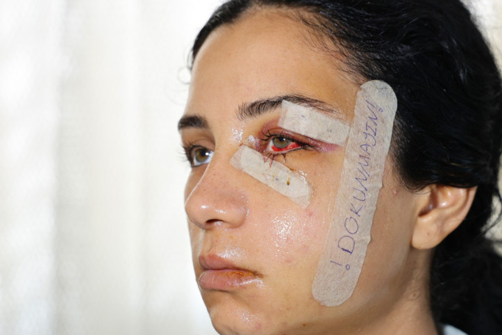 Öldüresiye dövüp serbest kaldı, kadının isyanı sonrası tutuklandı