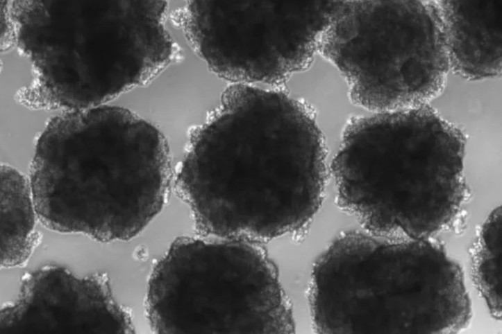 Araştırma: İnsanları 2 milyon yıldır zehirliyor