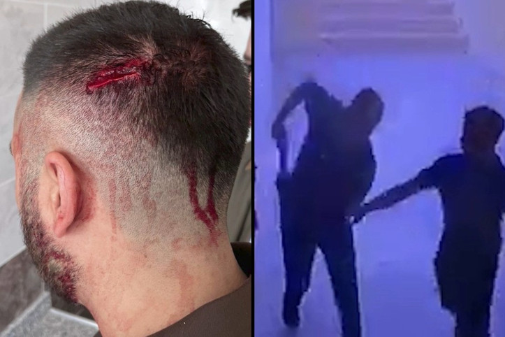 Öğretmene okulda demir sopalı saldırı: Görevi bıraktı