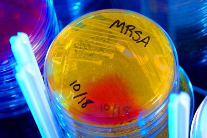Tıp dünyasını heyecanlandıran 'tesadüfi' keşif: Dirençli bakterilere karşı 100 kat daha etkili