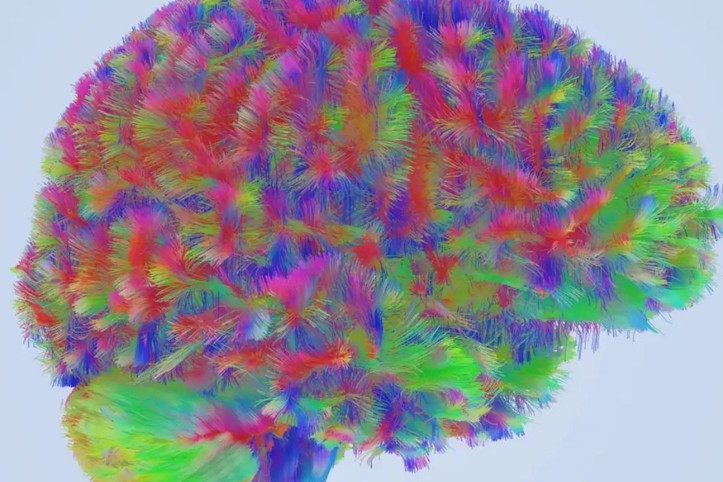 Bilim insanları insan beyninin gelişimini haritalandırdı: İşte dört kritik yaş