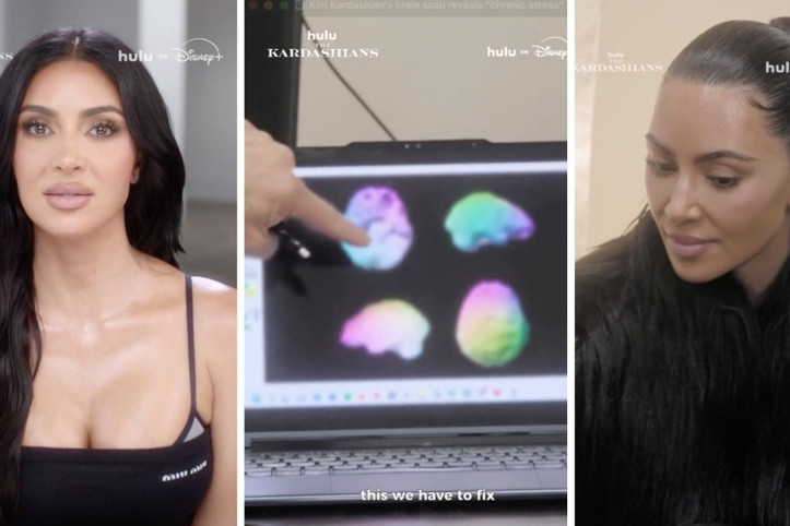 Kim Kardashian beyin taramasından geçti: Sonuca inanamadı