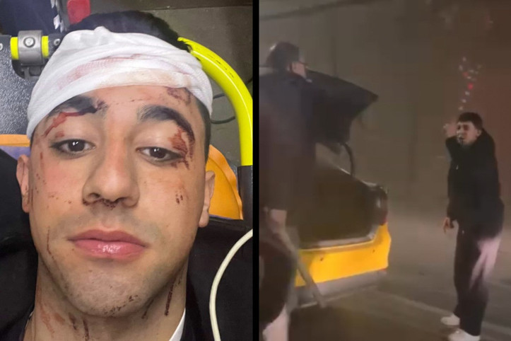 Tünelde taksici dehşeti: Sopayla kafasına defalarca vurdu