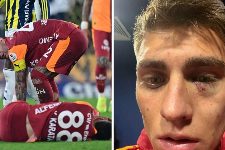 Galatasaray, Kazımcan'ın gözünün son halini paylaştı
