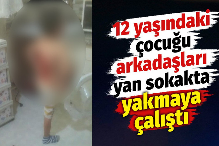 12 yaşındaki çocuğu arkadaşları yan sokakta yakmaya çalıştı