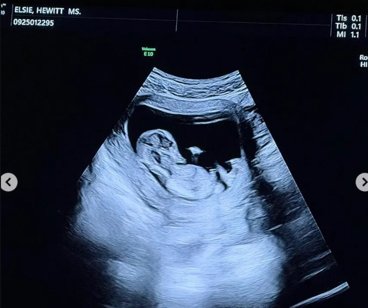 Komedyen Pete Davidson baba oluyor - Resim : 2