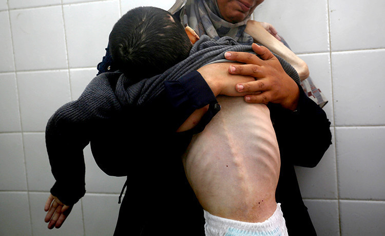 13 yaşındaki Tamir, annesinin kollarında açlıktan öldü - Resim : 3