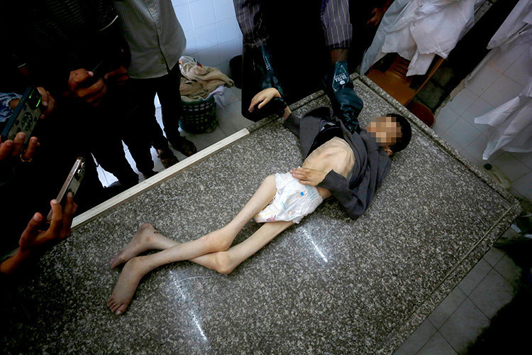 13 yaşındaki Tamir, annesinin kollarında açlıktan öldü - Resim : 2