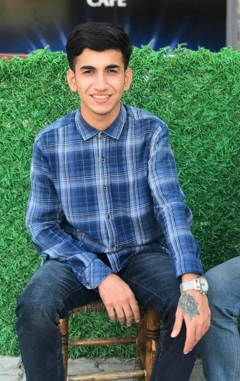 Dövme sildirmek isterken kabusu yaşadı, elindeki dokular öldü - Resim : 1