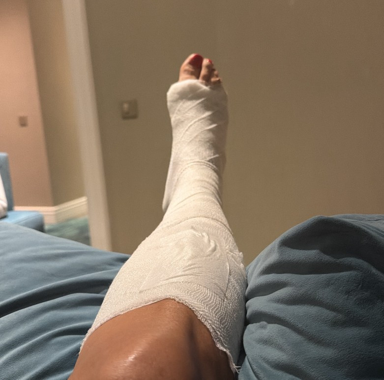 Işın Karaca talihsiz kaza sonrası hastaneye kaldırıldı - Resim : 1