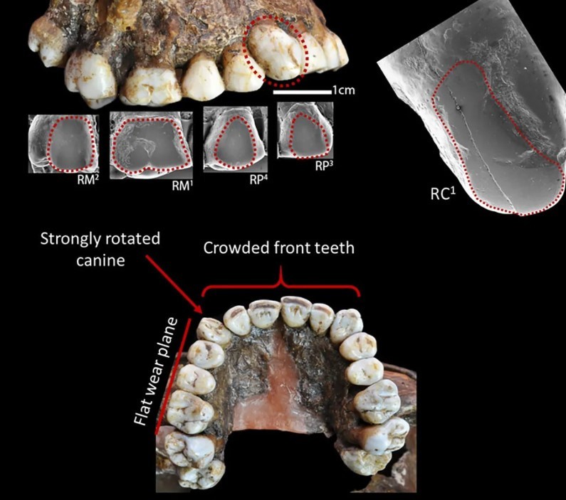 29 bin yıllık diş kanıtı: Buz Devri insanları yanak piercingi kullanıyormuş - Resim : 1