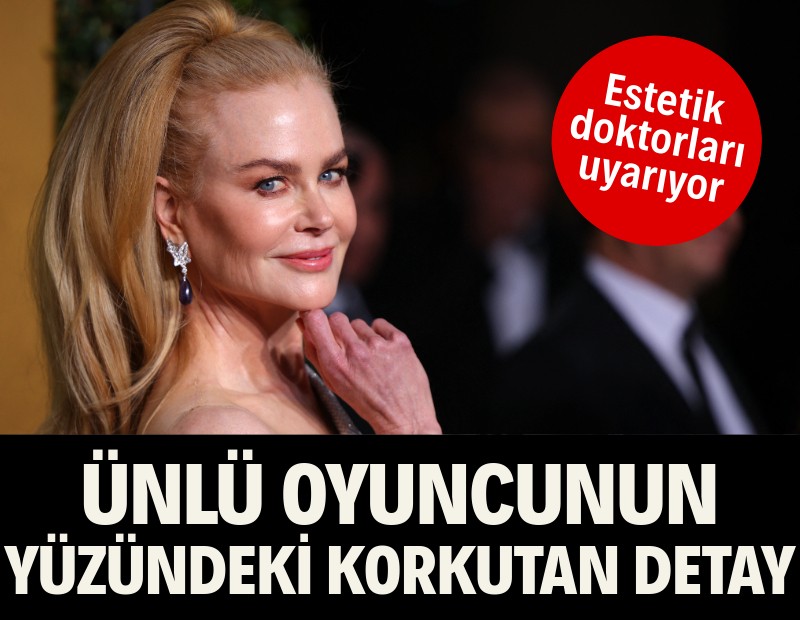 Nicole Kidman'ın yüzündeki hayranlarını korkutan detay