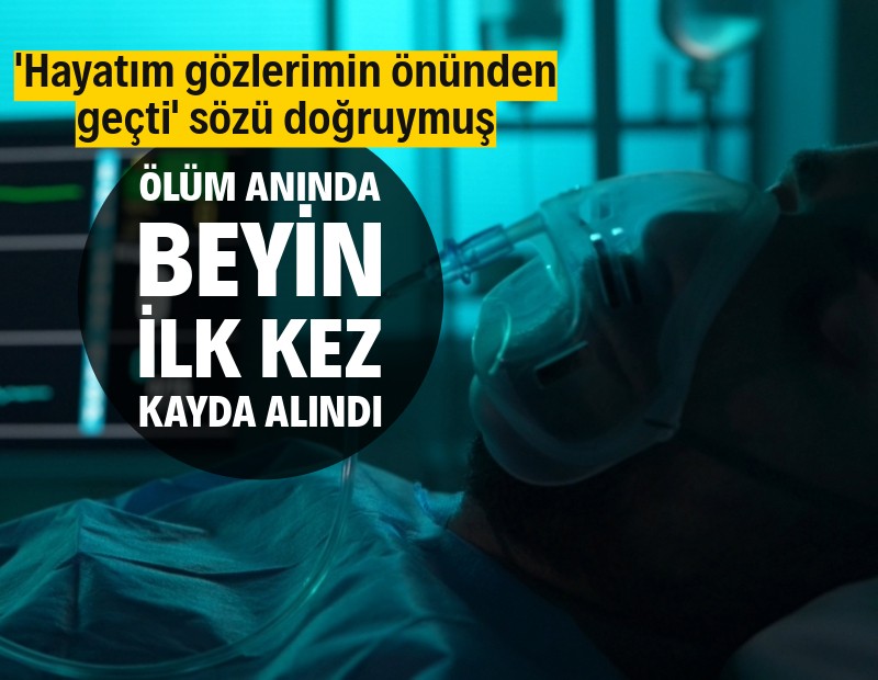 Bilim insanları ilk kez ölmek üzere olan bir kişinin beyin aktivitelerini kayda aldı