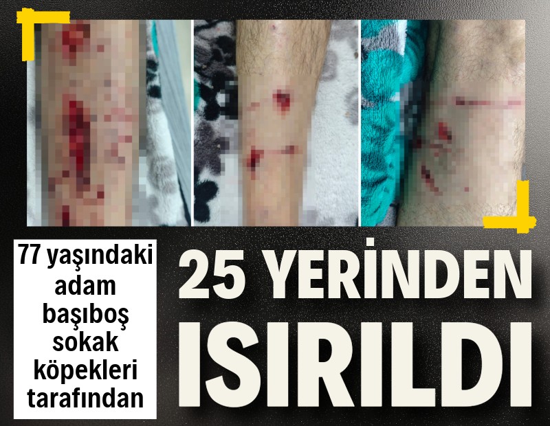 77 yaşındaki adam başıboş sokak köpekleri tarafından 25 yerinden ısırıldı