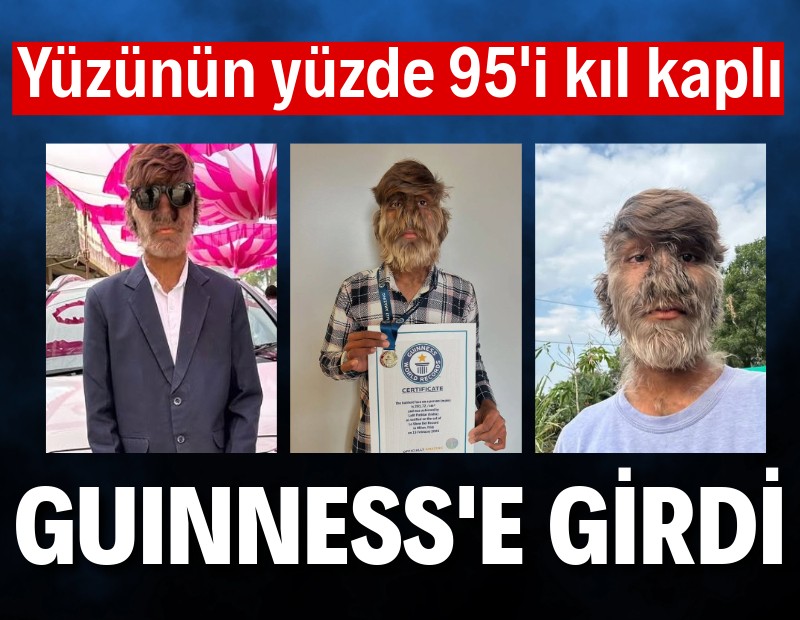 Guinness rekoru: Dünyanın en kıllı yüzlü insanı oldu