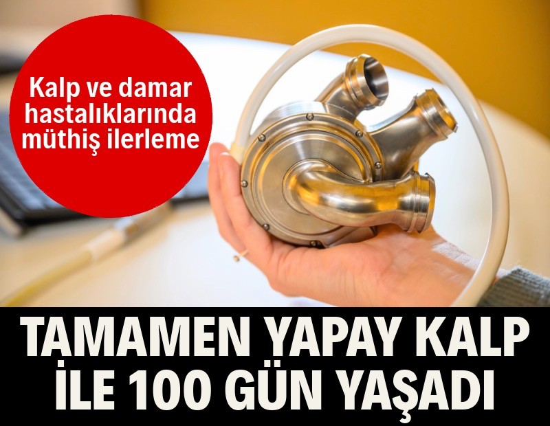 Yapay kalp ile 100 gün yaşadı