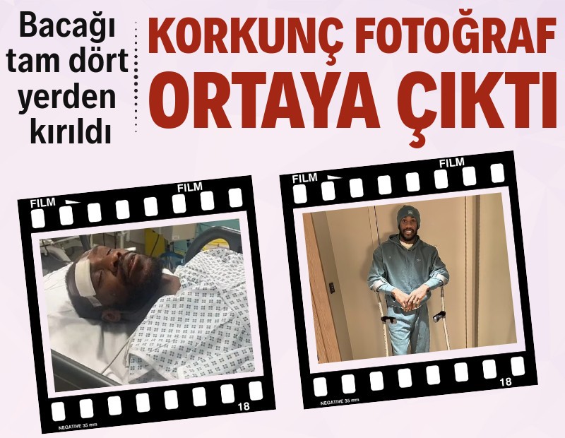 Korkunç fotoğraf ortaya çıktı: Ölümle burun buruna geldim