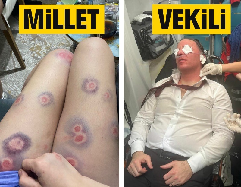 CHP'li Deniz Yavuzyılmaz'a polisten sert müdahale