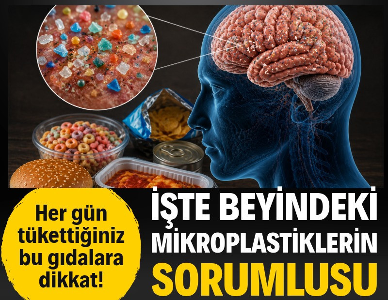 Beyinde biriken mikroplastiklerin kaynağı ortaya çıktı