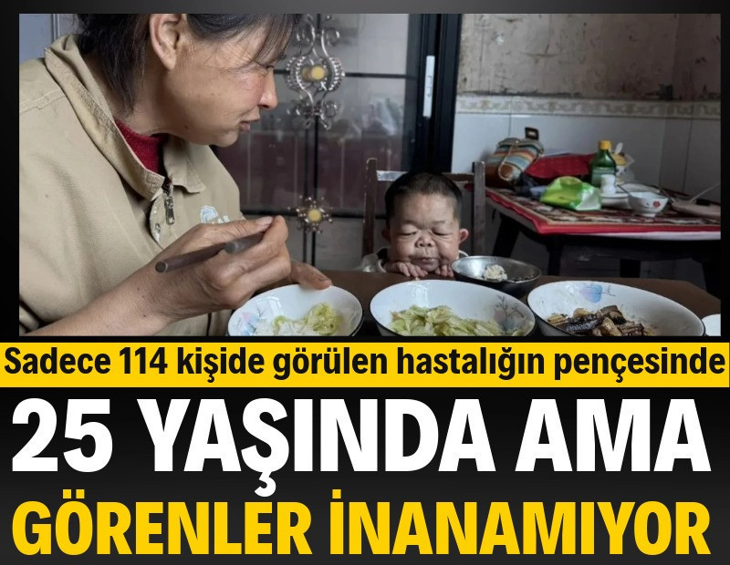 25 yaşında ama görenler inanamıyor