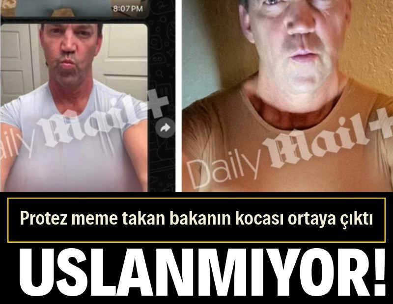 Protez meme takan bakanın kocası uslanmak bilmiyor