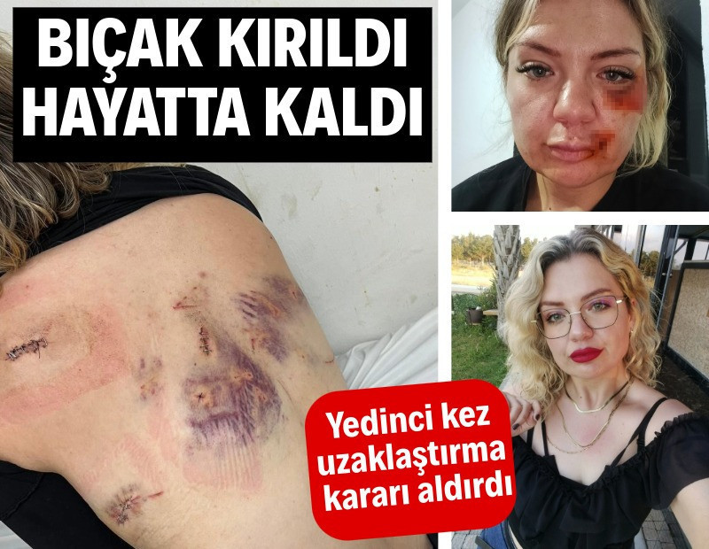 Bıçak kırılınca hayatta kaldı: 7'nci kez uzaklaştırma kararı aldırdı