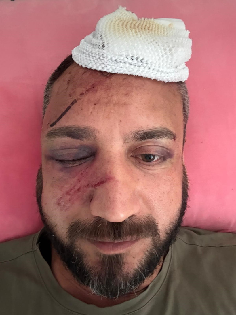 Sevgilisinin ailesini icraya verdi, bu hale geldi - Resim : 1