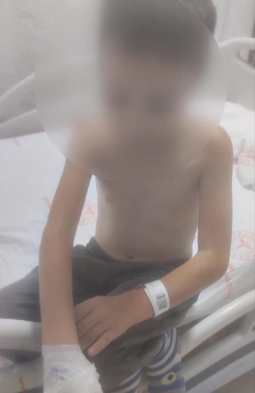 12 yaşındaki çocuğu arkadaşları yan sokakta yakmaya çalıştı - Resim : 4