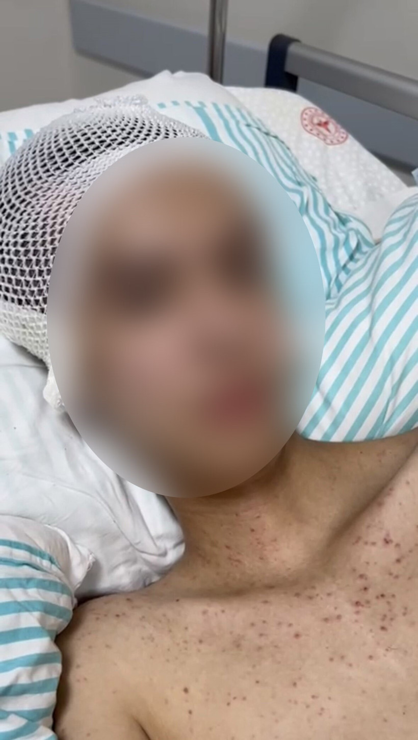 'Tacize direndiğim için vuruldum' dedi, felç geçirdi - Resim : 1